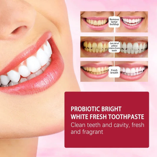 SP-4 Ultrab+ Probiotic Bright White Fresh